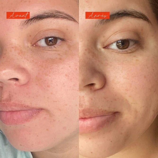 Café en terrasse - Actif lissant et regénérant