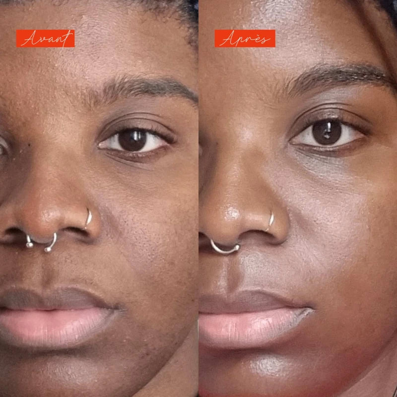 Soirée disco - Actif Séborégulateur