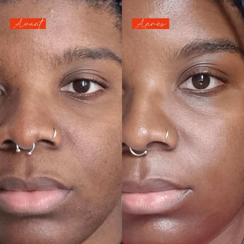 Soirée disco - Actif Séborégulateur