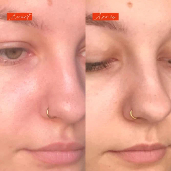 Soirée disco - Actif Séborégulateur