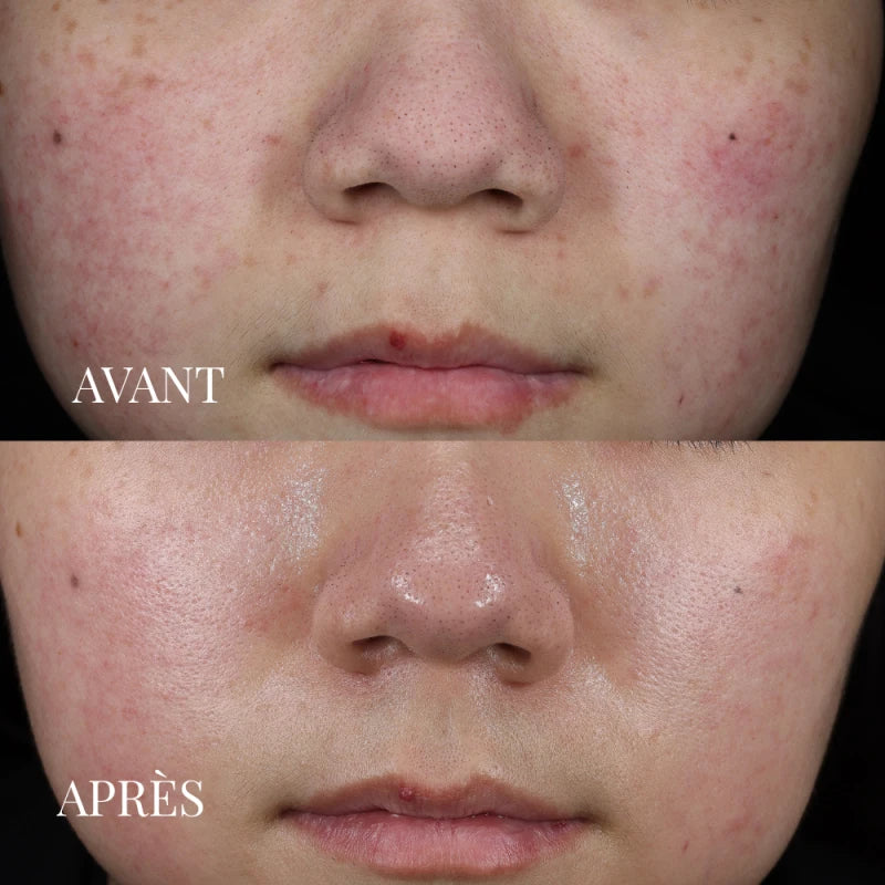 Masque Soin Détoxifiant