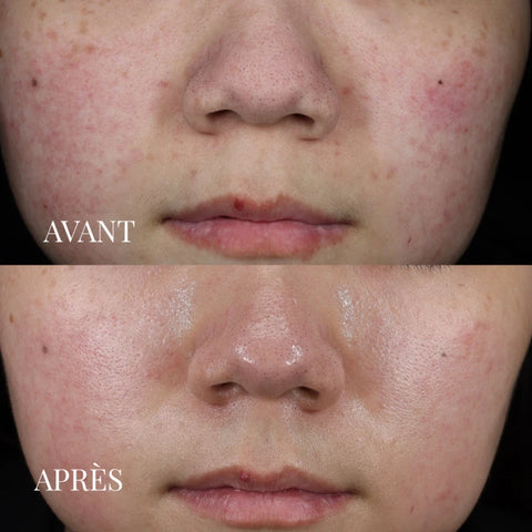 Masque Soin Détoxifiant