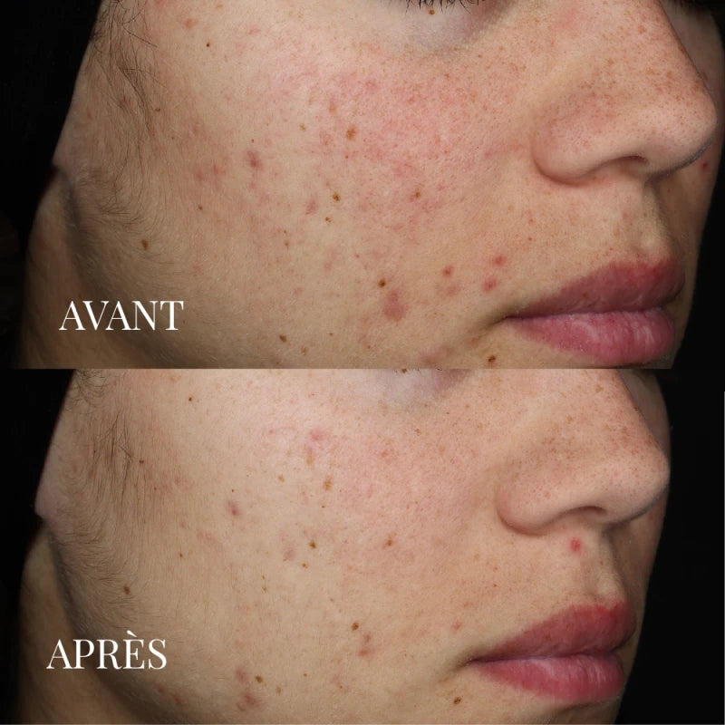 Masque Soin Détoxifiant